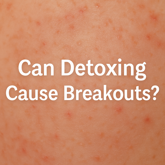Can Detoxing Cause Acne Breakouts?